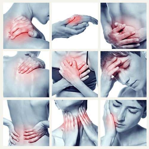 Zone del corpo colpite dalla fibromialgia