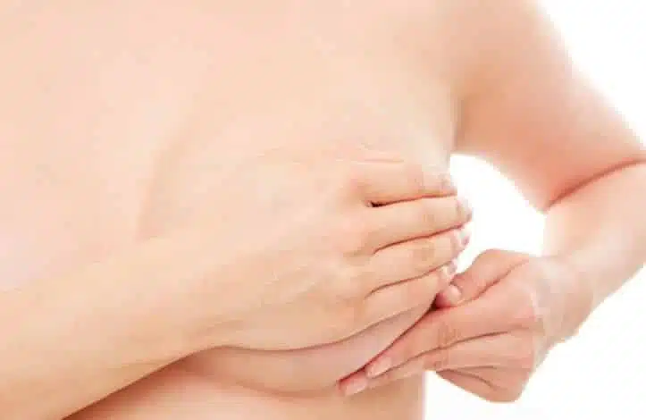 mastite