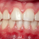 Dente - Odontoiatria