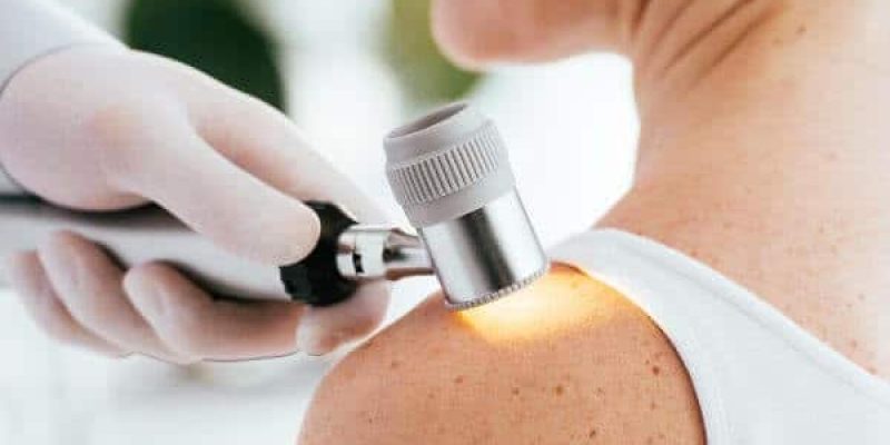 Medico dermatologo controlla pelle di una paziente