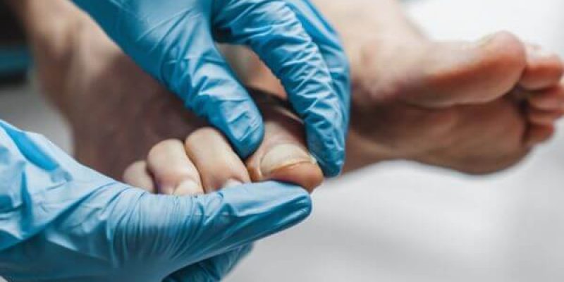 Mani con con guanti di un podologo e piedi di un paziente durante visita podologica