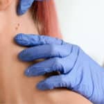 dermatologo a domicilio controlla nei sul collo di una paziente