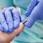 Mani con guanti di un podologo mentre cura unghia di un paziente